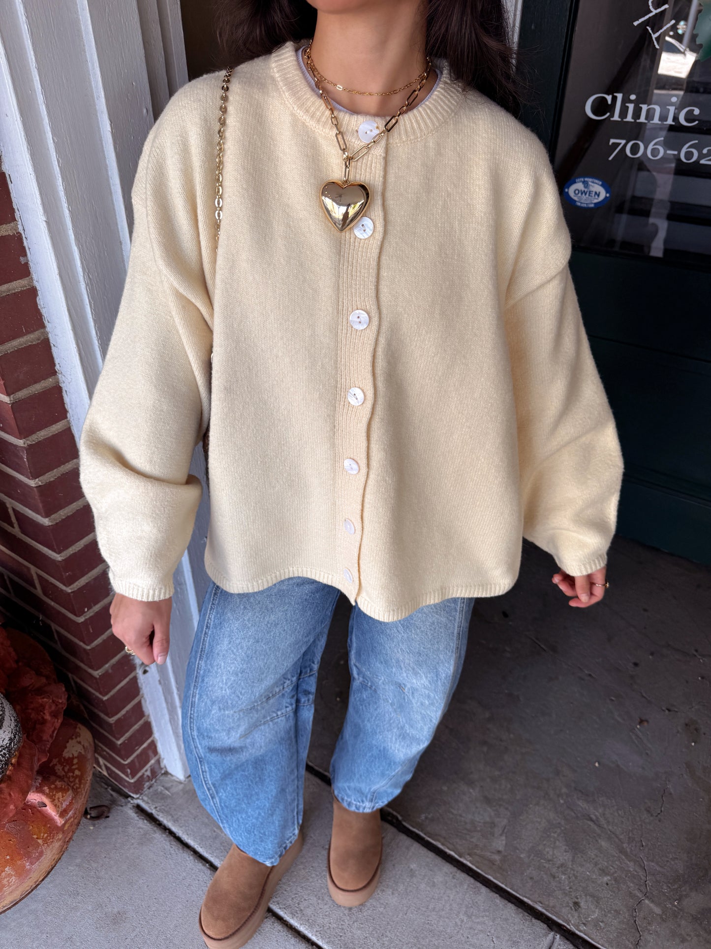Butter Yellow Oversized Button Up Cardigan